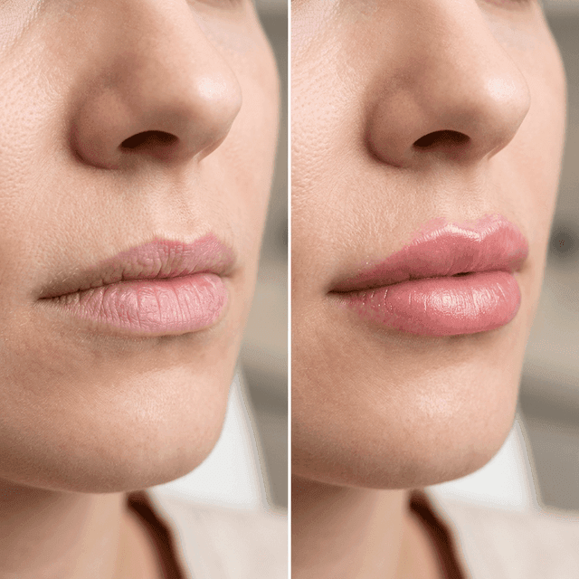 Hidratación de Labios